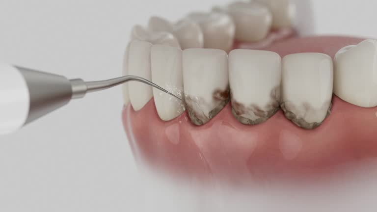 Reliable Dental contractor in Bridgeport, CT by Smile Center Dentistry